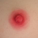 #2